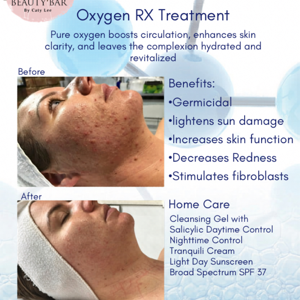 Oxygen RX Facial at Mi Piel Beauty Bar in Beltsville, MD
