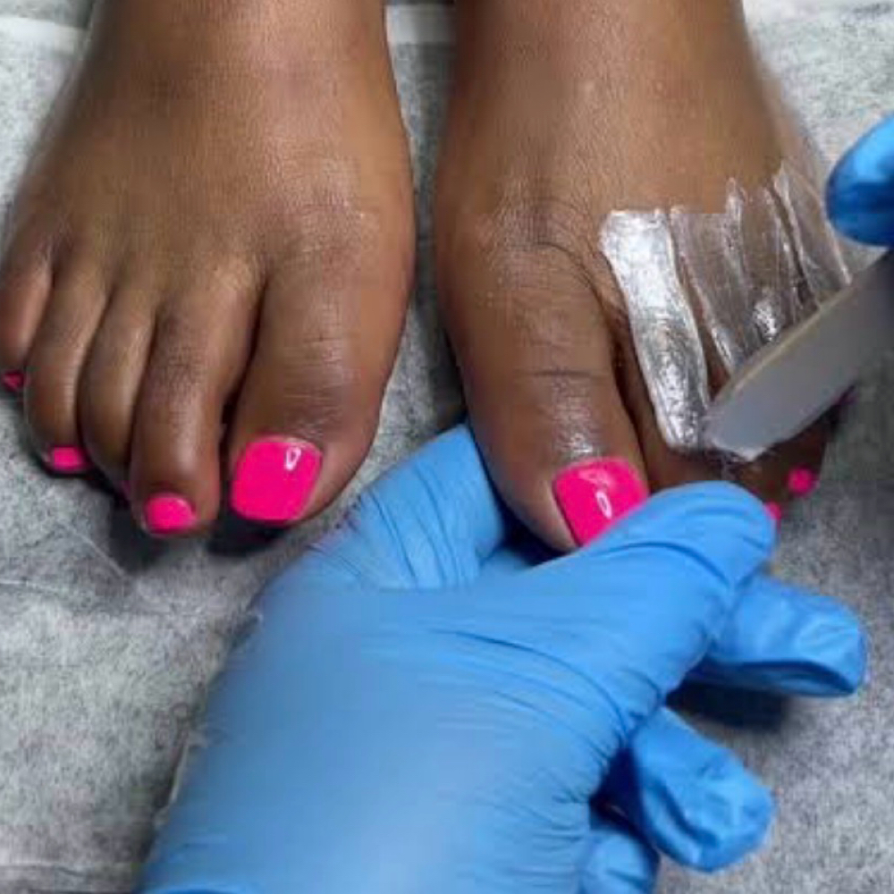 Toes at The Bare Studio Esthetics, LLC in Moline, IL
