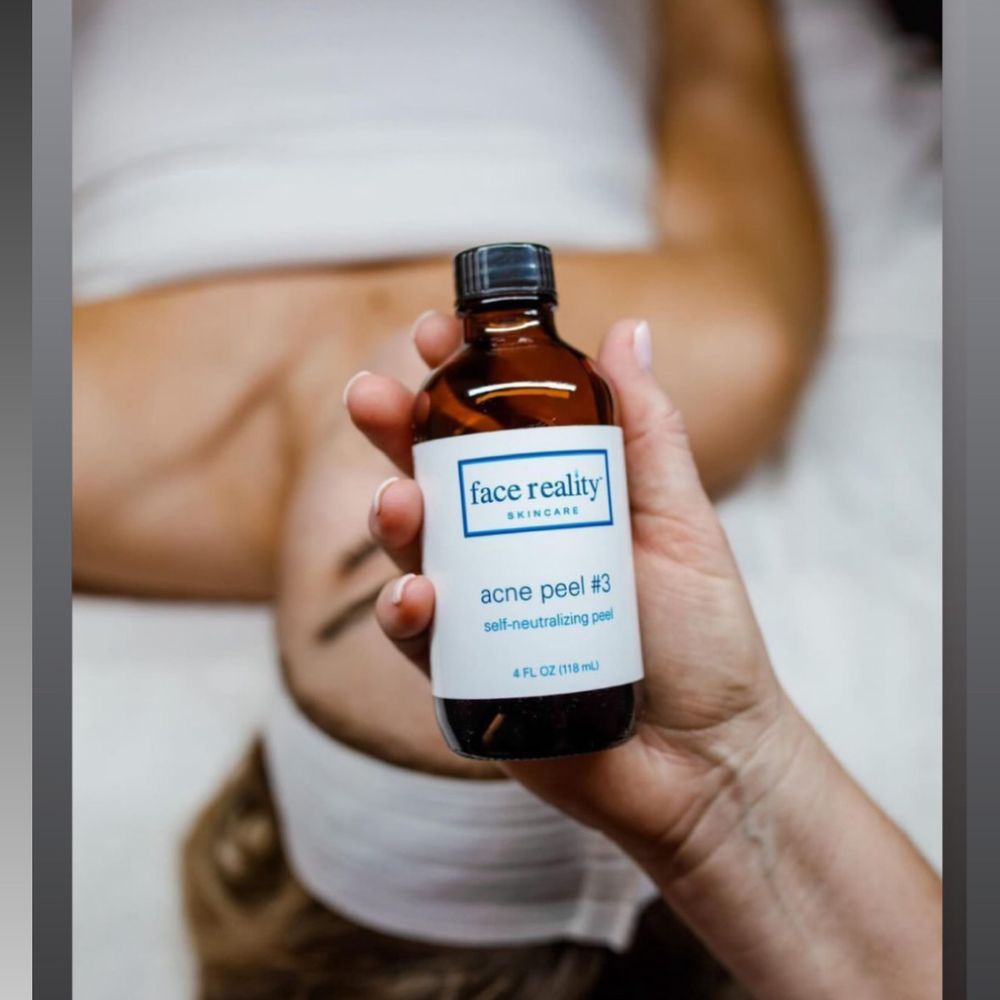 Acne Bootcamp Consultation