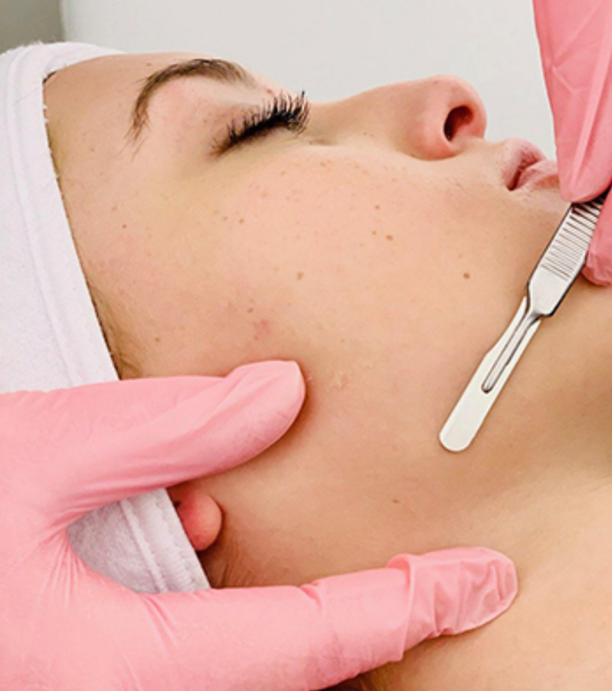 SKT: Facial W/ Dermaplaning