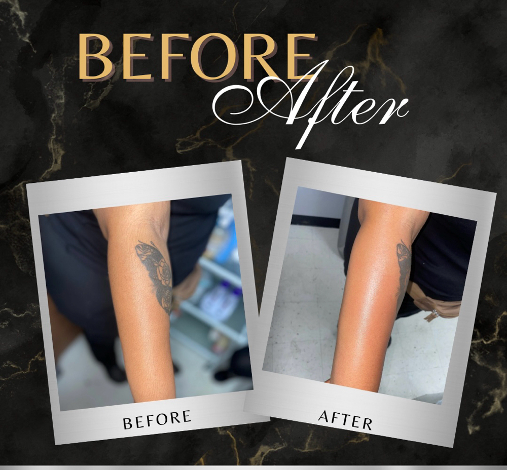 Lower Arm Wax