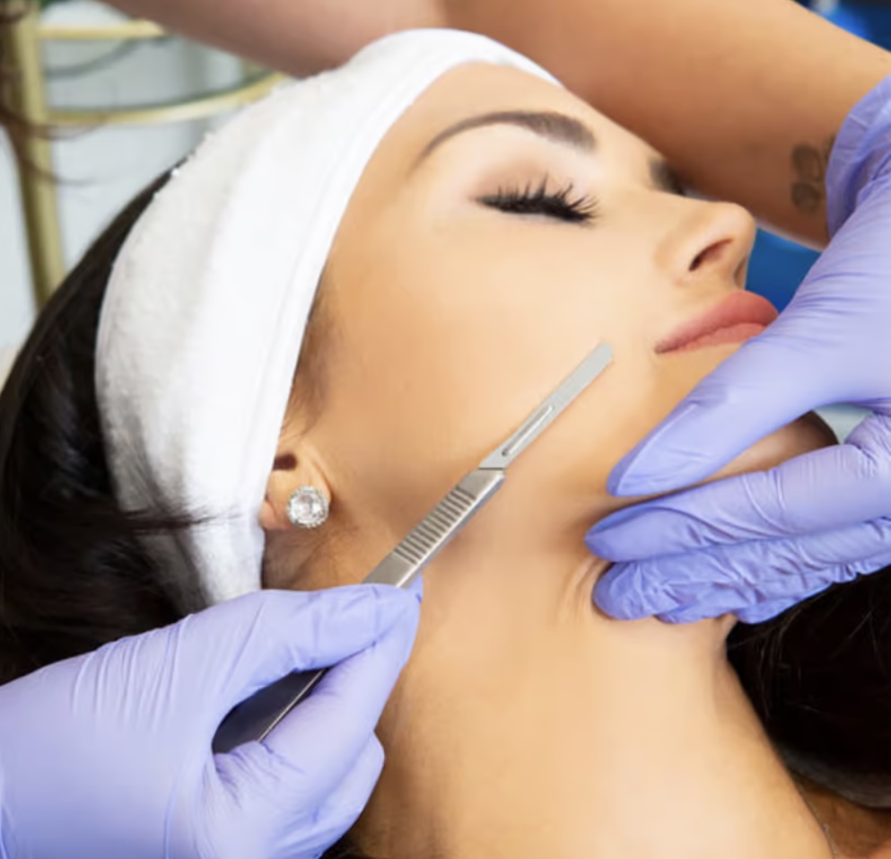 Dermaplaning - ADD ON