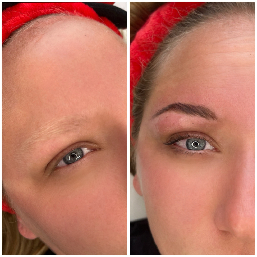 Brow Lamantion