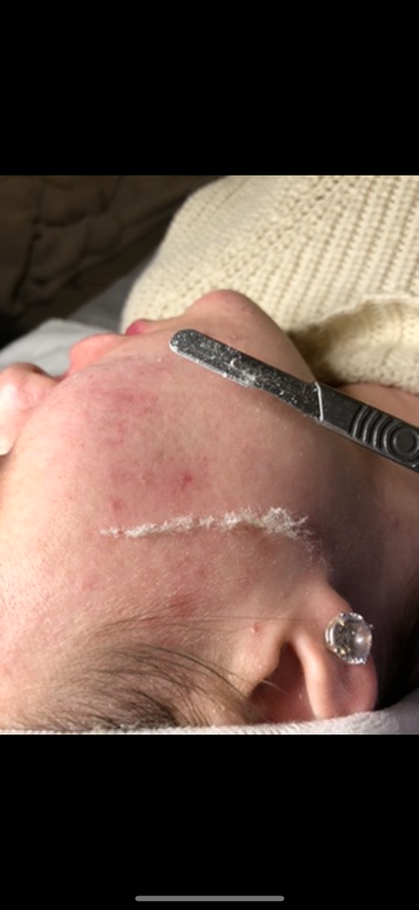 DERMAPLANE FACIAL