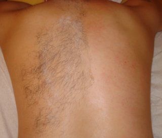 Upper Back Wax