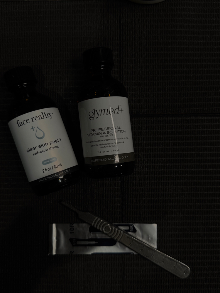 Age Managment Chemical Peel