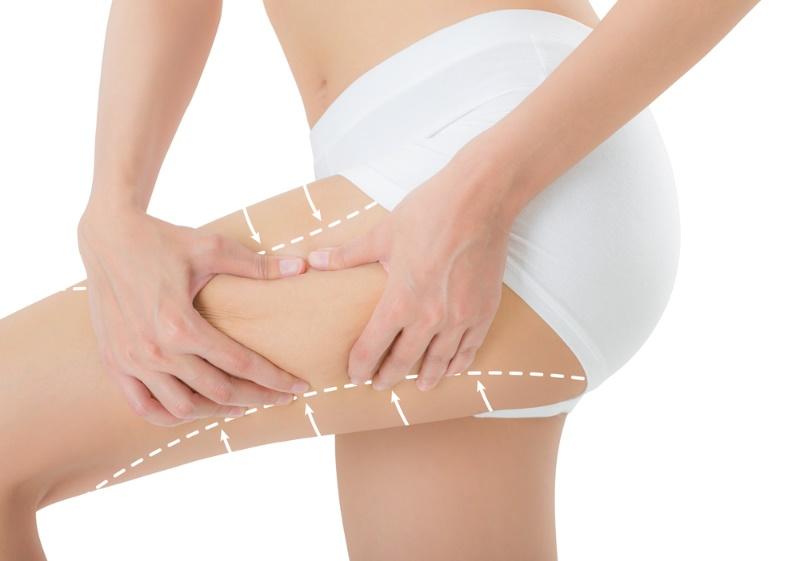 Stetik Shape Anti-Cellulite