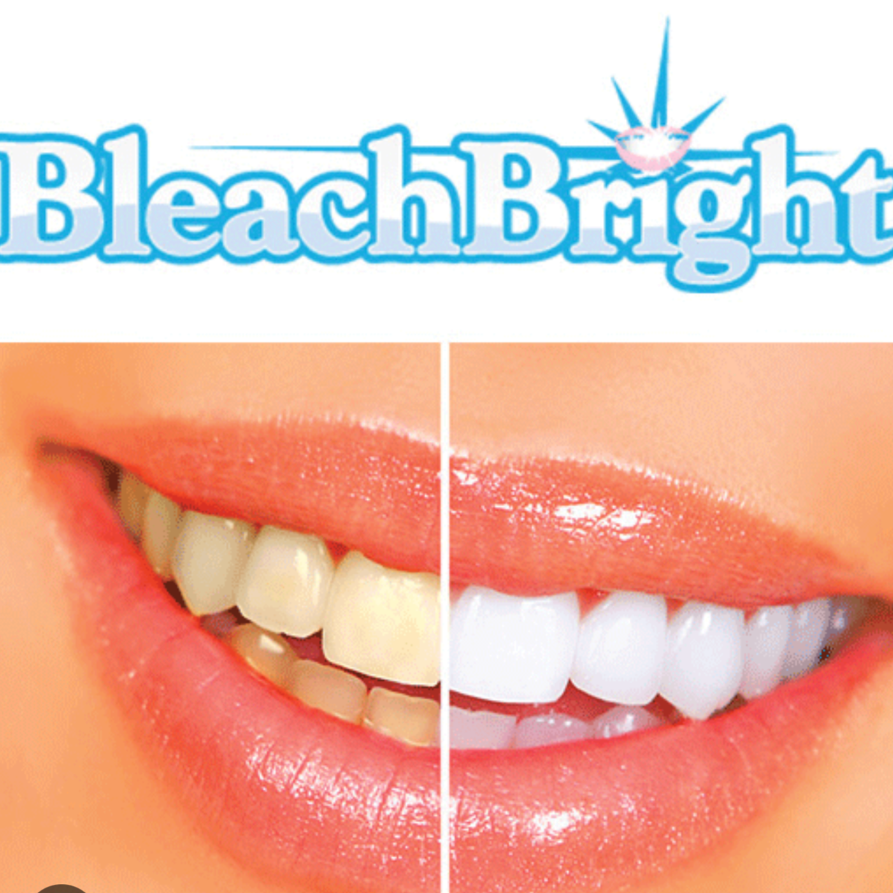 Add-on Teeth Whitening at Outlash in Star, ID