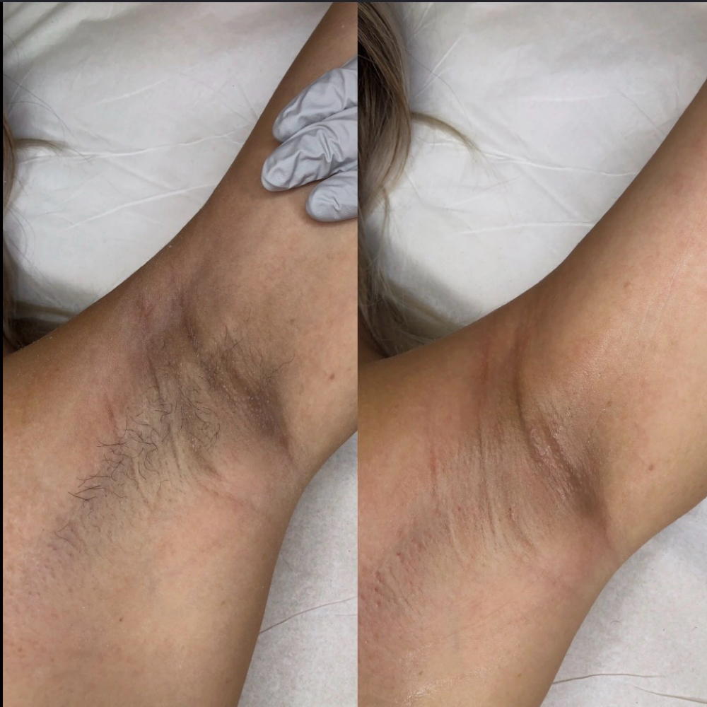 Underarm Wax at Pretty Lady Esthetics in Ontario, OH