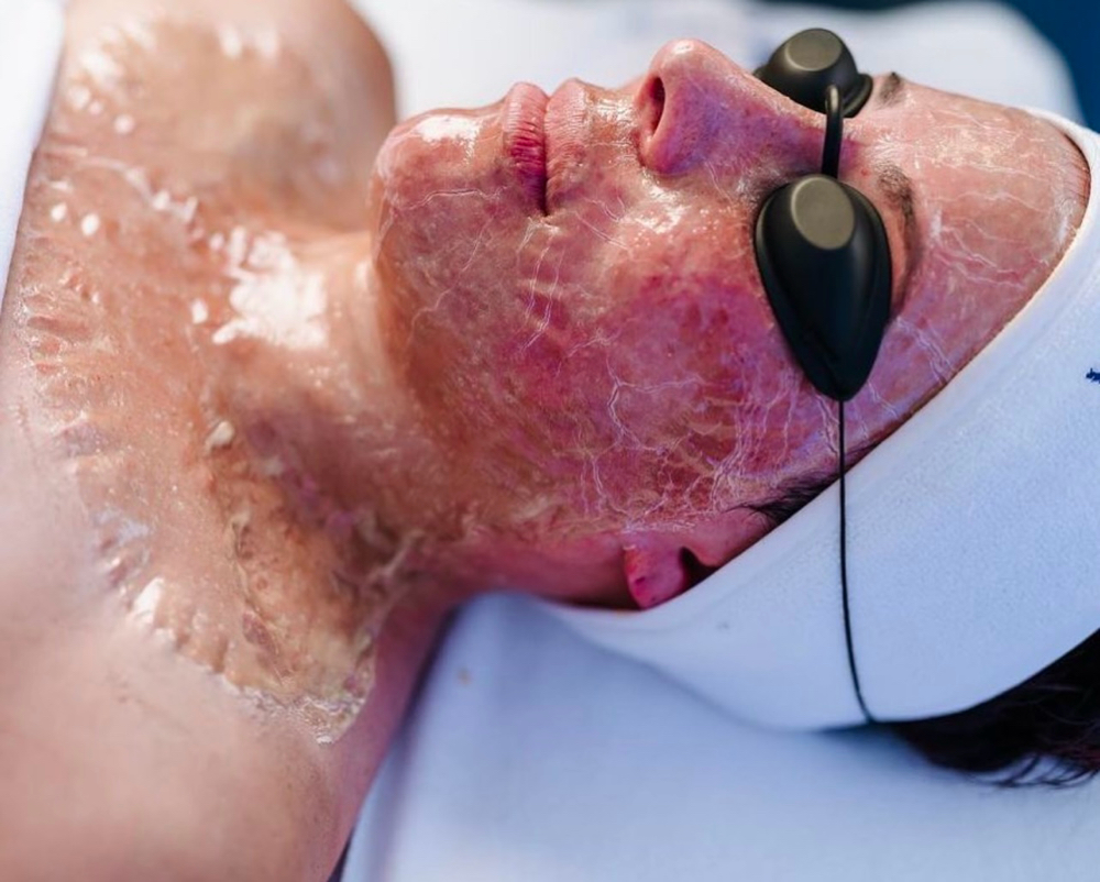 Peptide Firming Mask