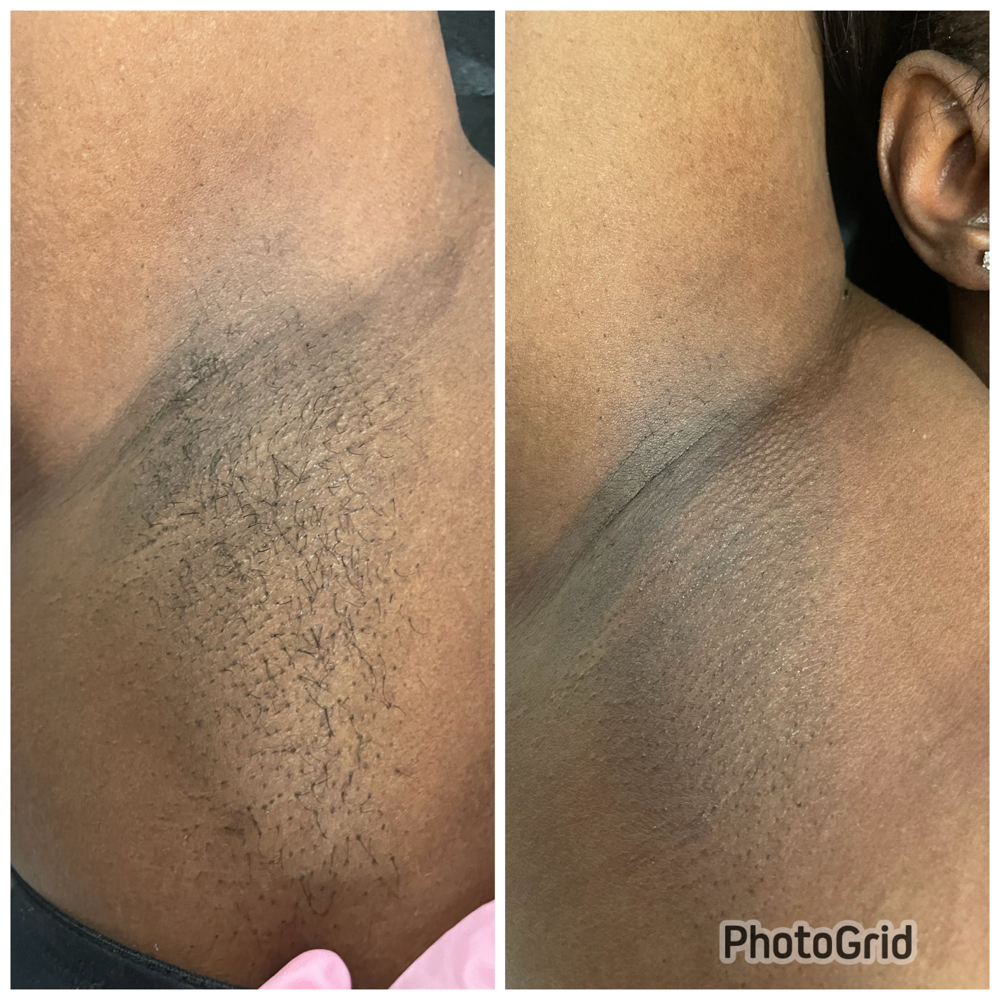 Underarm Wax