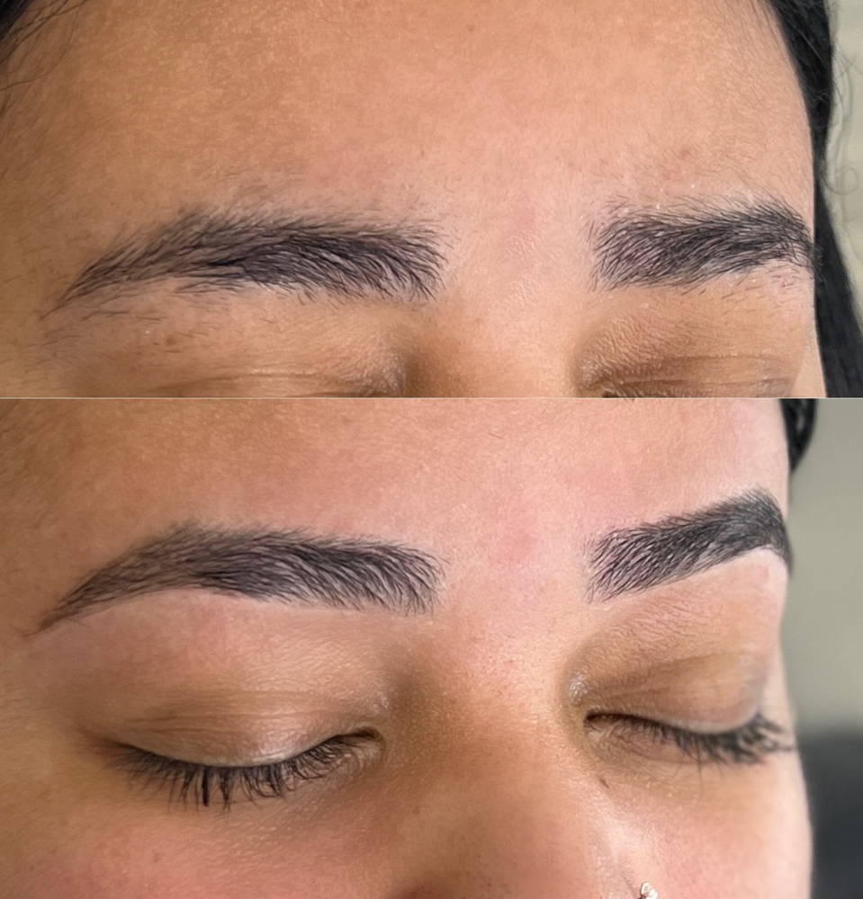 Brow Rehab
