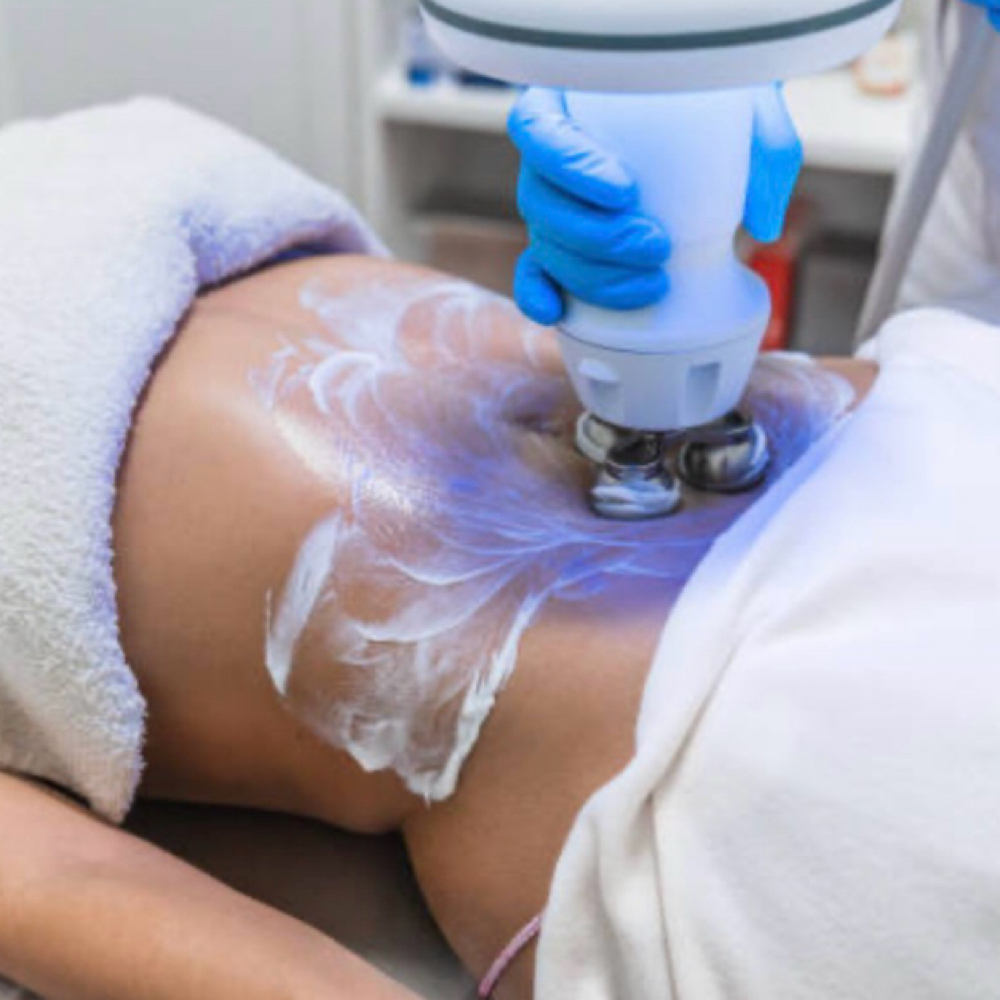 HG BODY SCULPT | PAID SESSION at Hourglass Body Aesthetics in Green Bay, WI