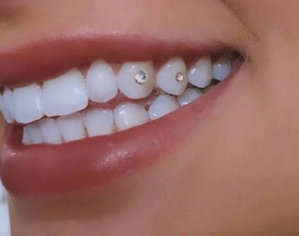 2 Teeth Gems