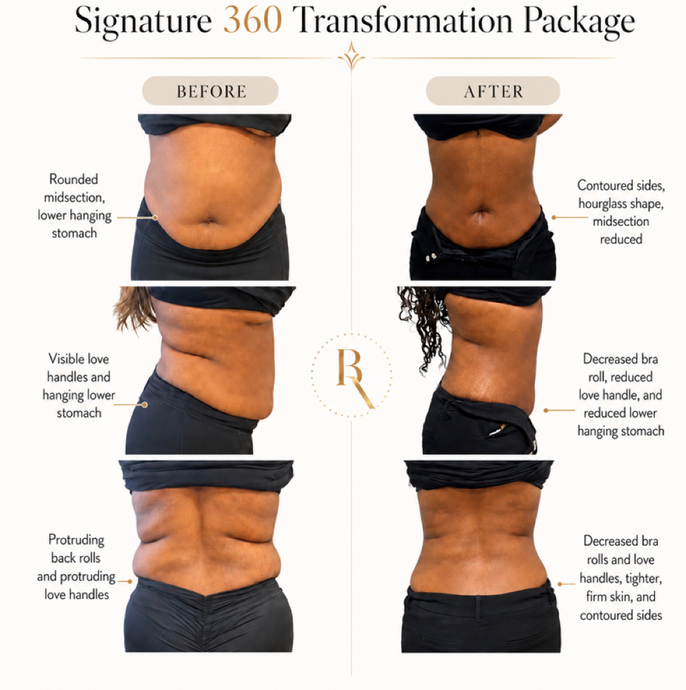 SIGNATURE 360 PACKAGE at BODIEDBYNICKEI LLC in The Bronx, NY