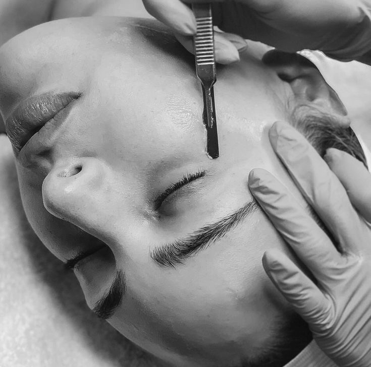 Dermaplane Facial