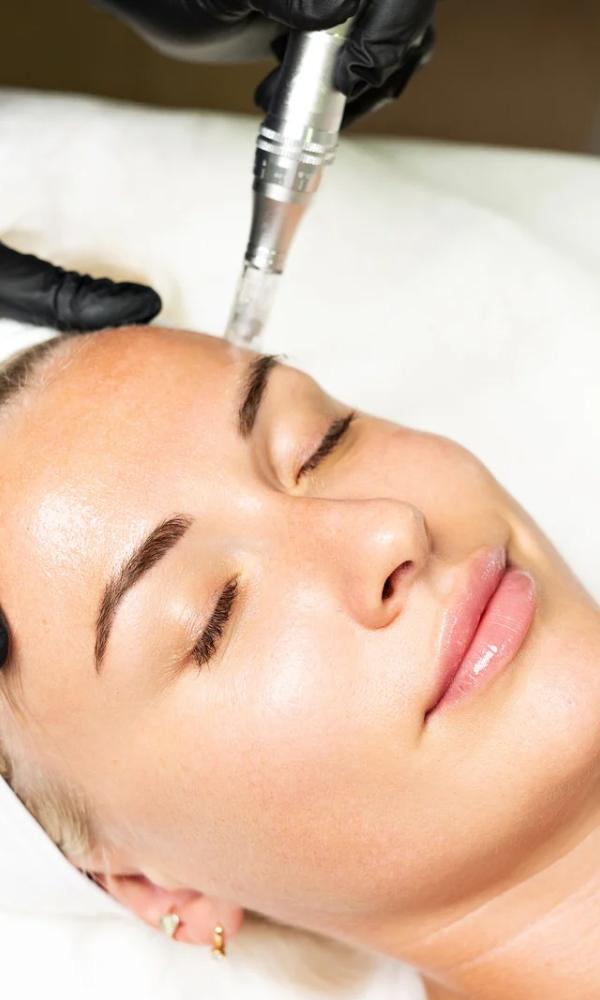 Microneedling Collagen Stimulation