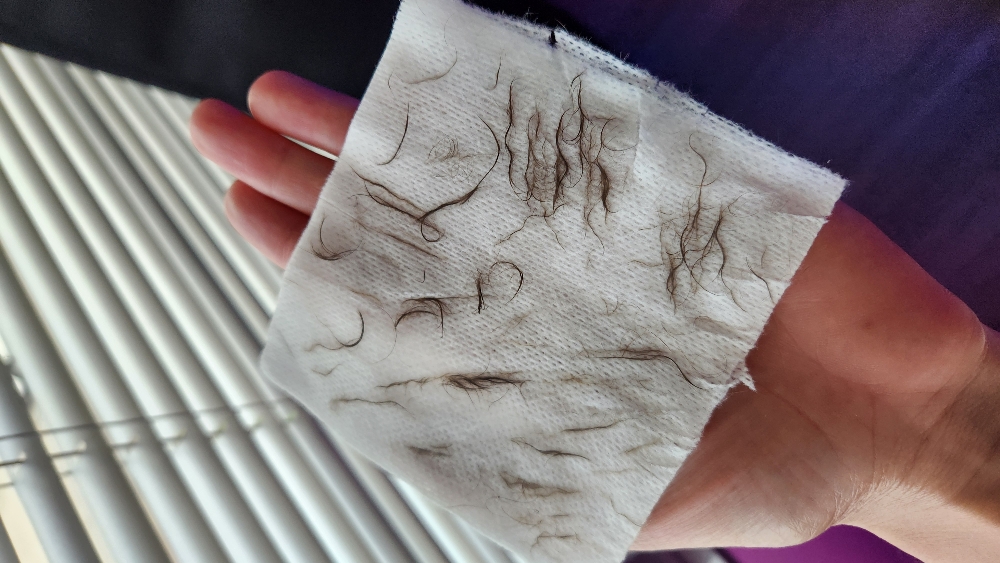 + EPIDERMAL LEVELING
