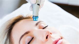 HydraFacial - Hydra Glow