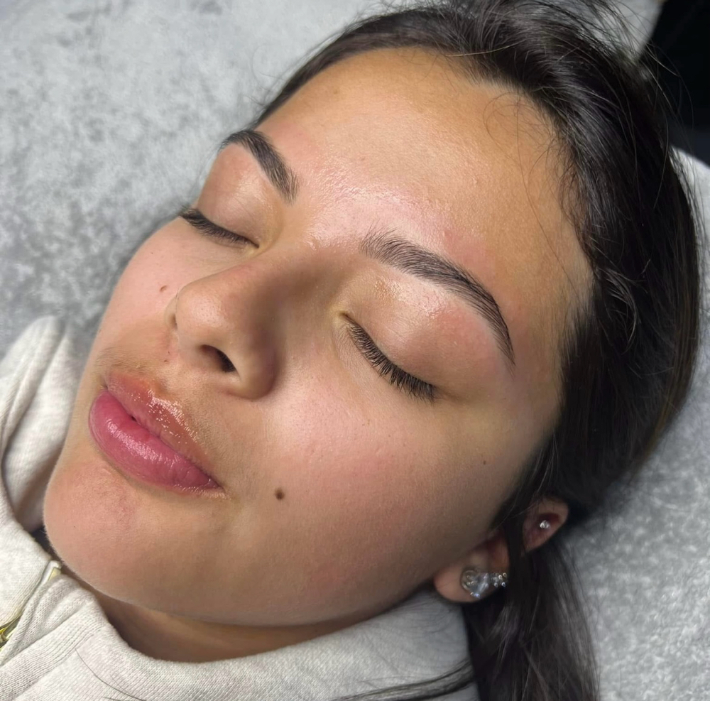 Brow Reshaping