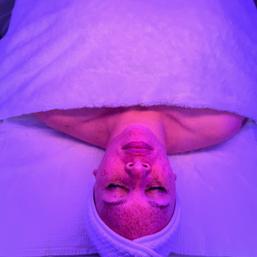 Sunshine Chemical Peel Facial