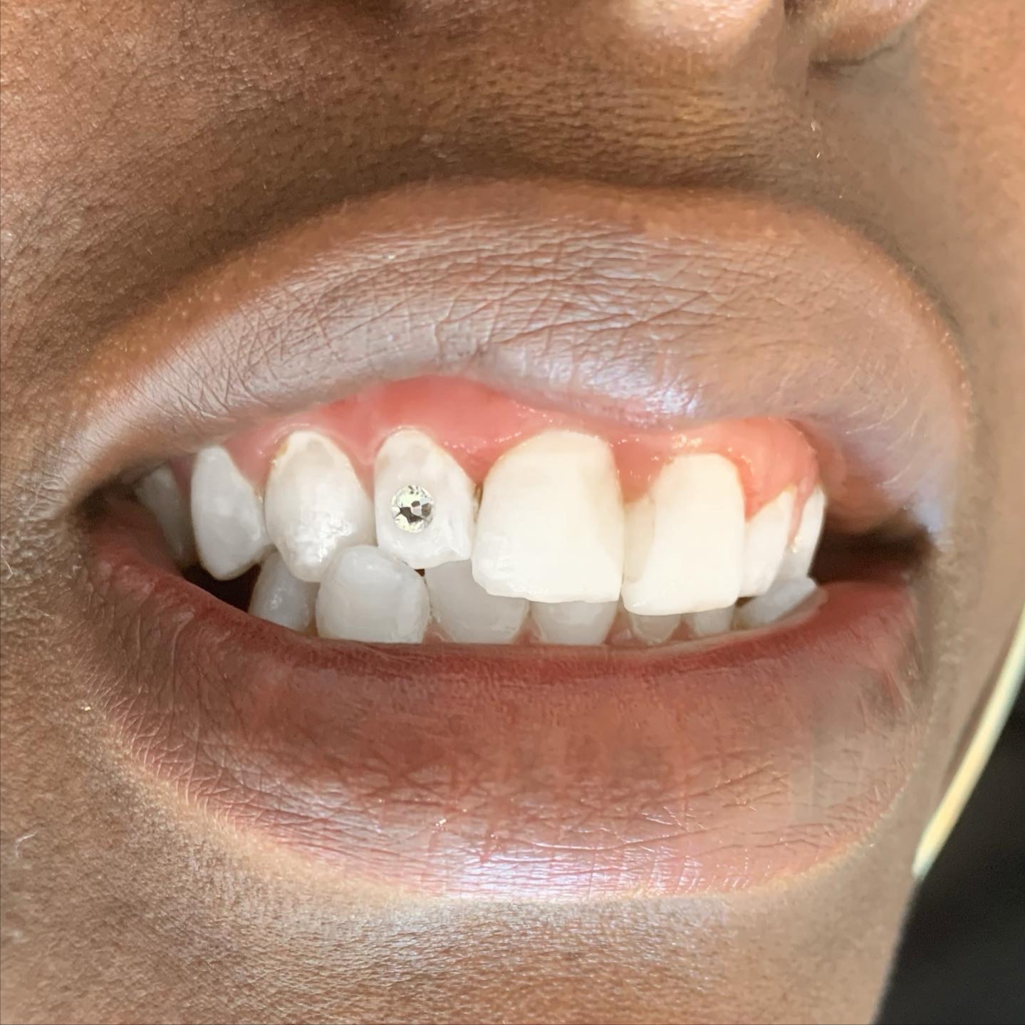 Tooth Gems at YOMA Cincinnati in Cincinnati, OH