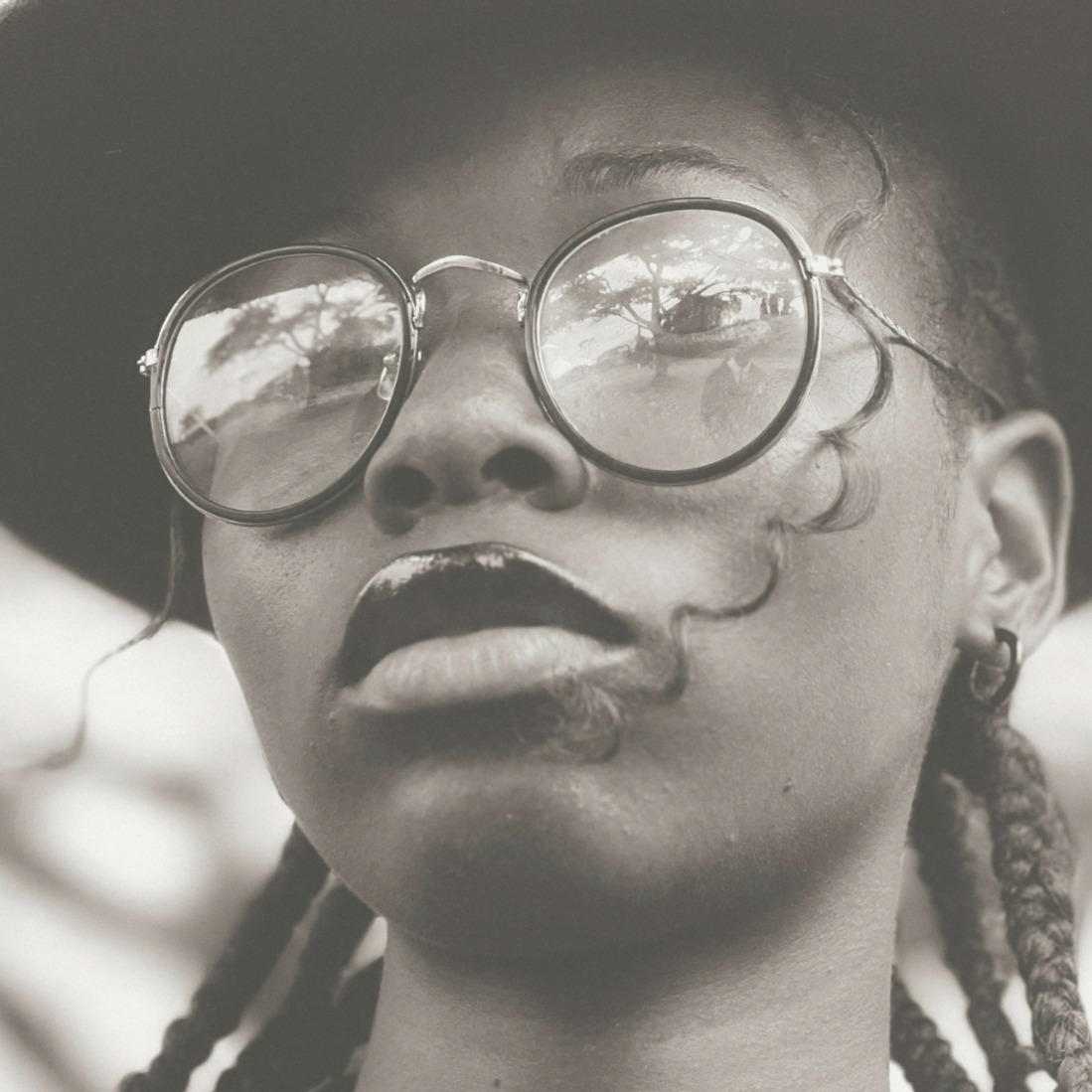 Platelet Rich Plasma at Vital Skin in Erie, CO