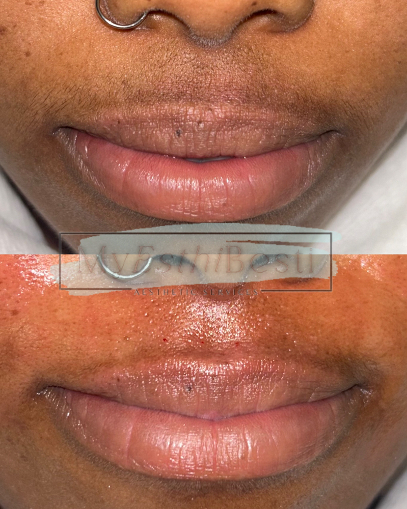 Lip Wax