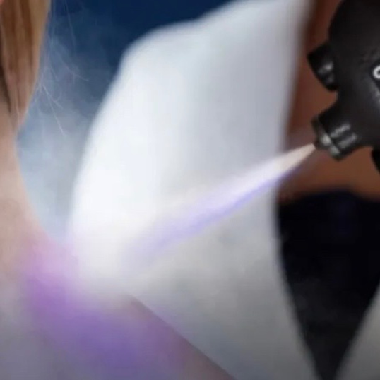 Localized cryotherapy at Glo Body Co. in Trenton, MO