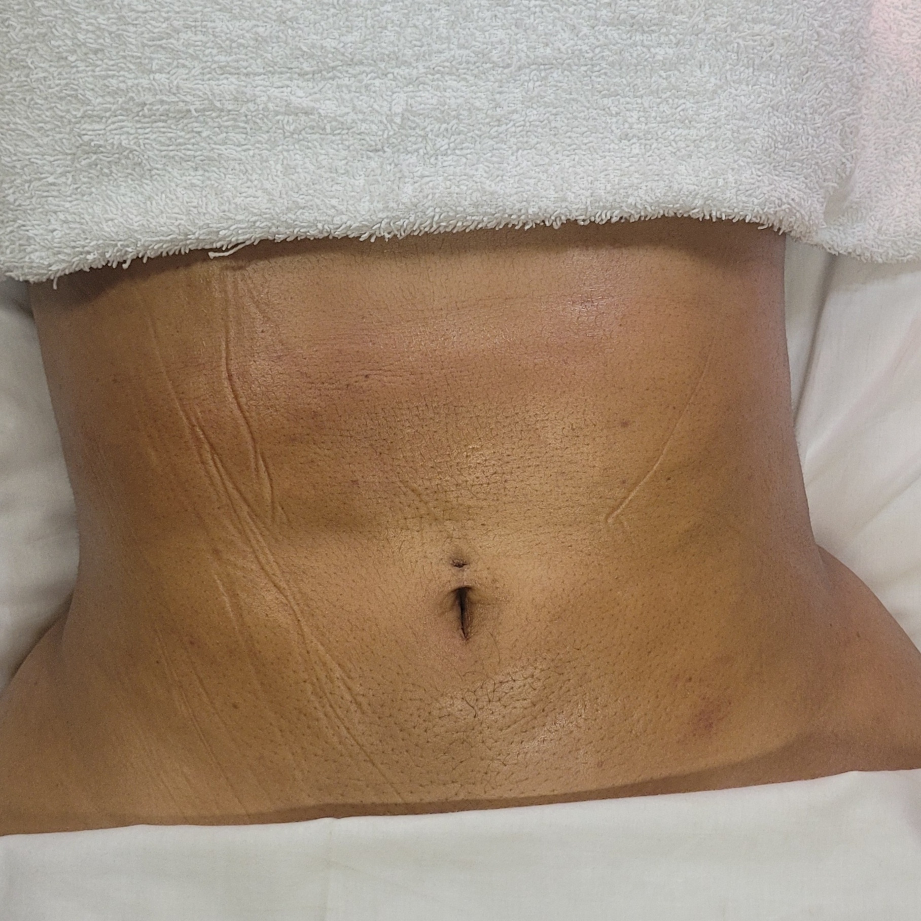 Post Operative Massage at Anointed Hands Massage & Spa Essentials - Newton in Newton, MA