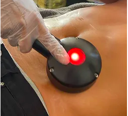 Cryo Breast Lift