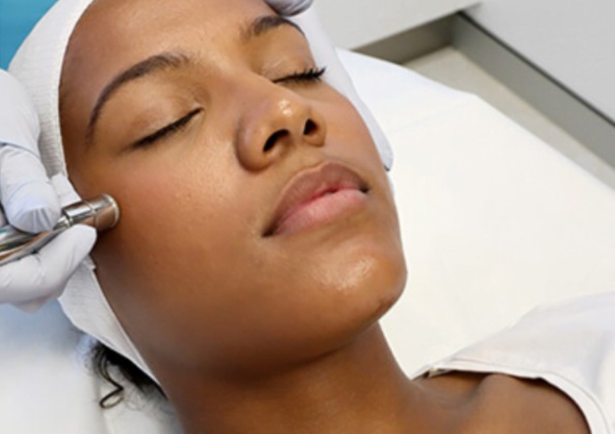 Microdermabrasion facial at Prestige Aesthetics KC in Independence, MO