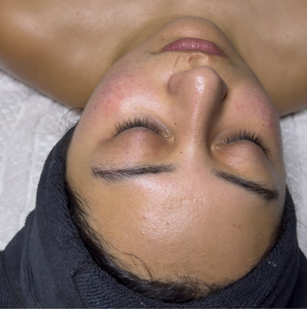 Customized Facial at Artemis Esthetics by Lorena LLC in Summit, IL