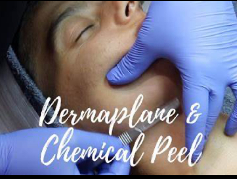 Dermaplan/Chem Peel Treatment