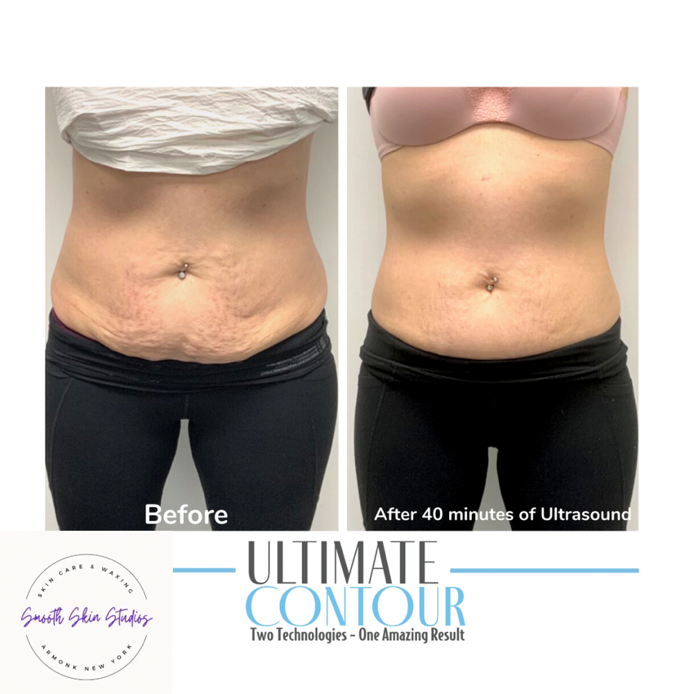 Body Sculpting W/ Ultimate Contour