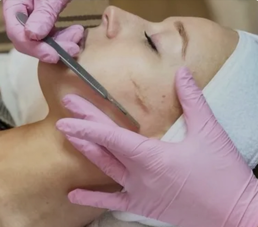 Dermaplane Services