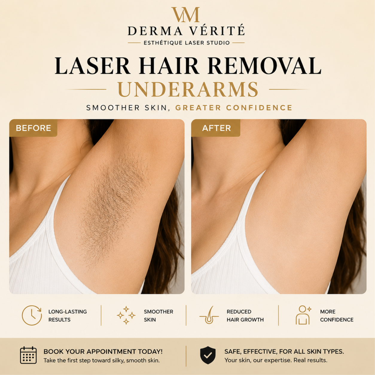 Underarm Laser Hair Removal at Derma Verite Esthetique Laser Studio in Elmhurst, NY