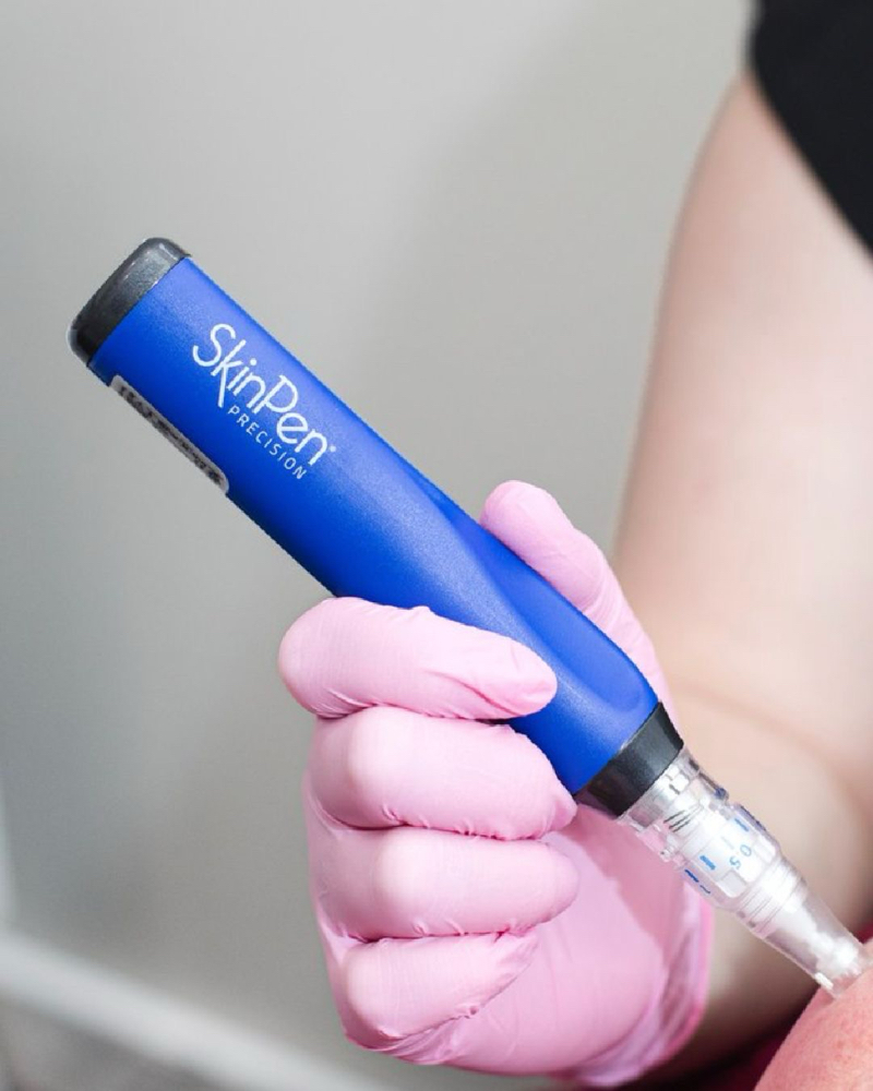 SkinPen- Microneedling