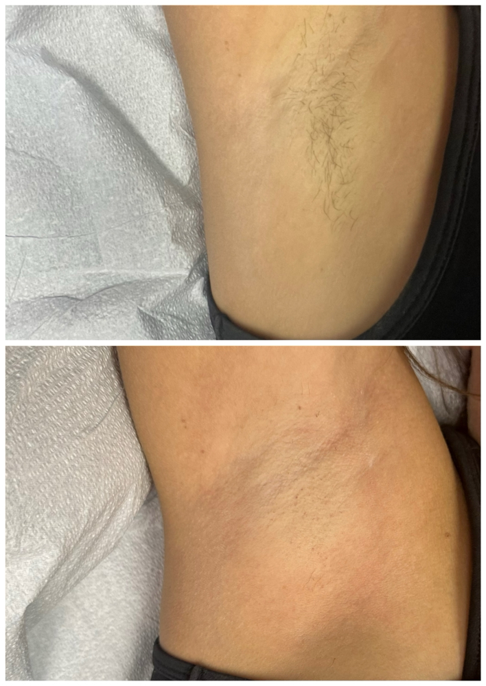 Arm Pit Wax at Sparkle Forever Beauty in Los Lunas, NM