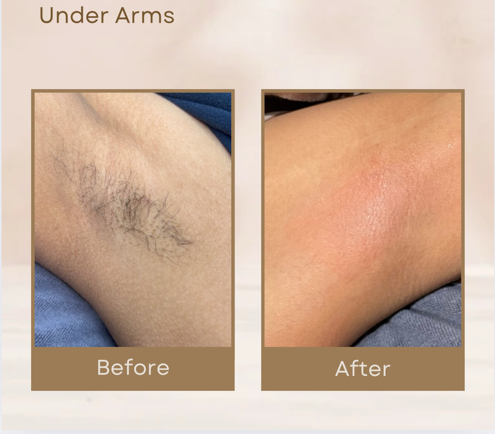 UNDERARMS WAX