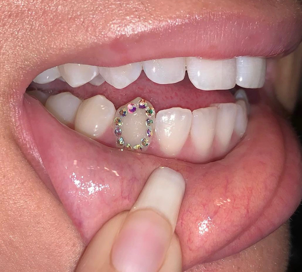 Halo Tooth Gems at Av.nue Bar AV Lashes in Peoria, AZ