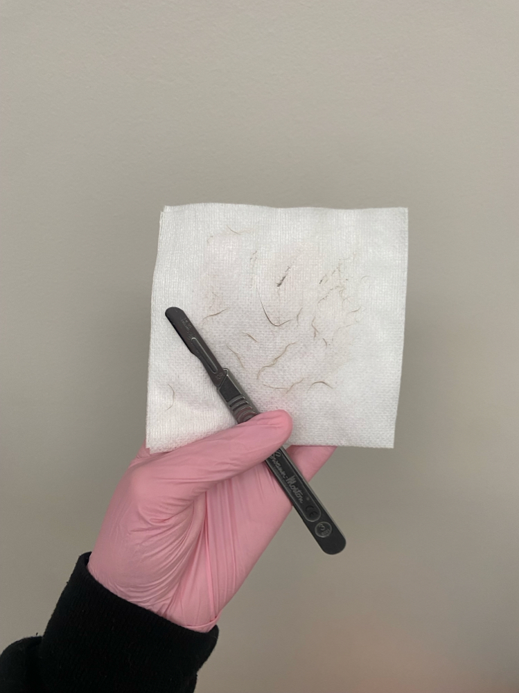 Deluxe Dermaplane