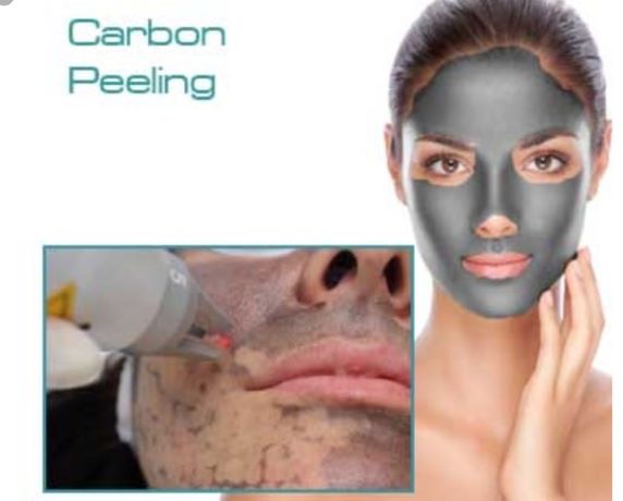 Hollywood Peel (Activated Charcoal) at PM Studio- Skin & Nails by Paola Mercado in Concord, CA