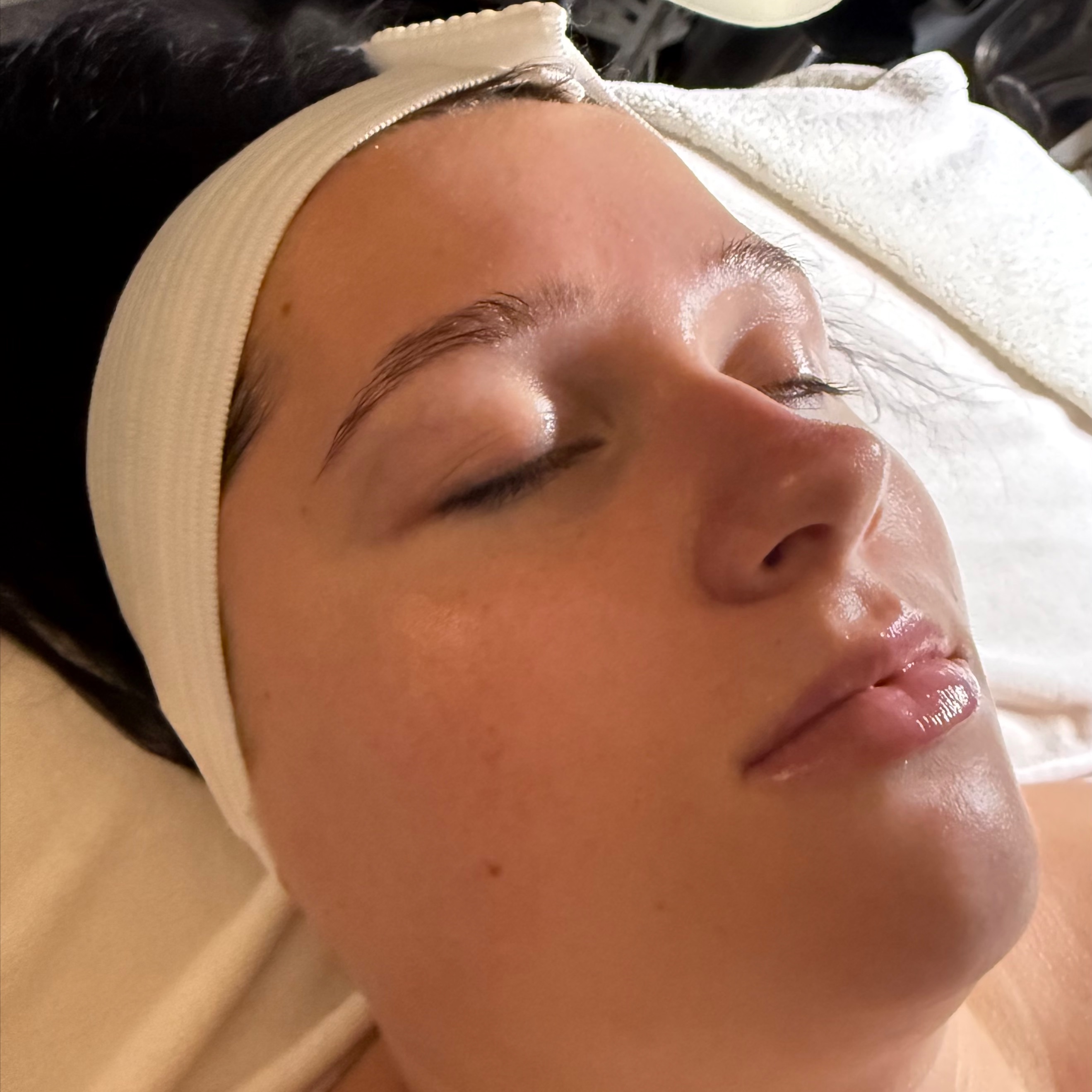 Personalized Skin Correction at Fitzskin in Gilbert, AZ