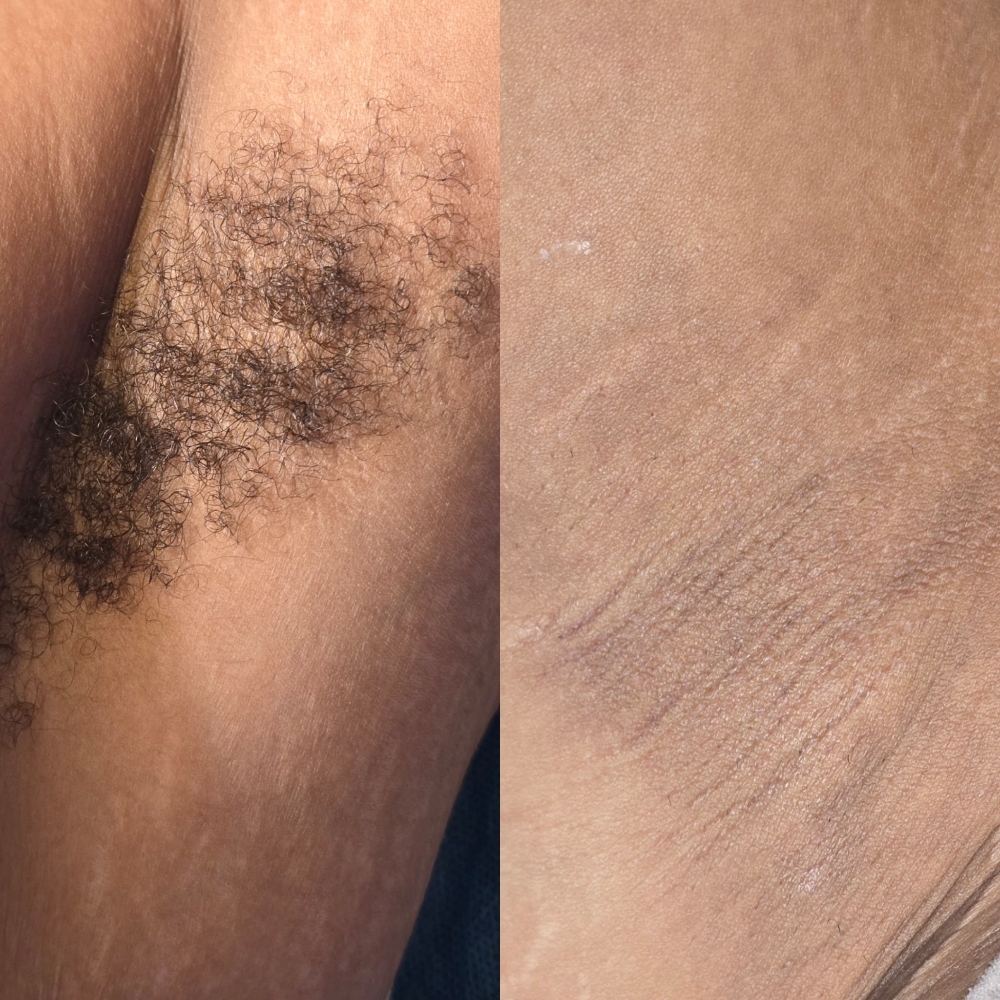 Arm Pit at Premier Beauty Lounge in Bronson, FL