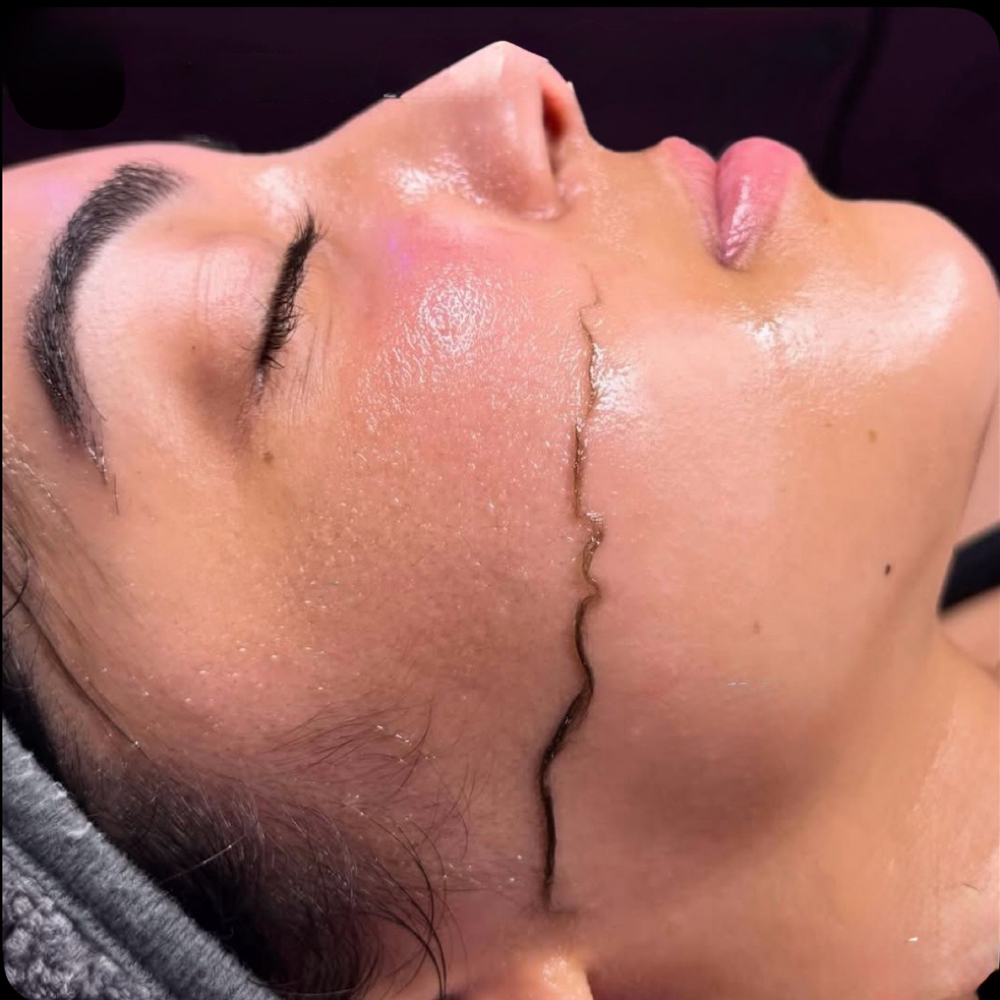 Glass Skin Express Dermaplaning at Sun kissed Esthetics in Little River, SC