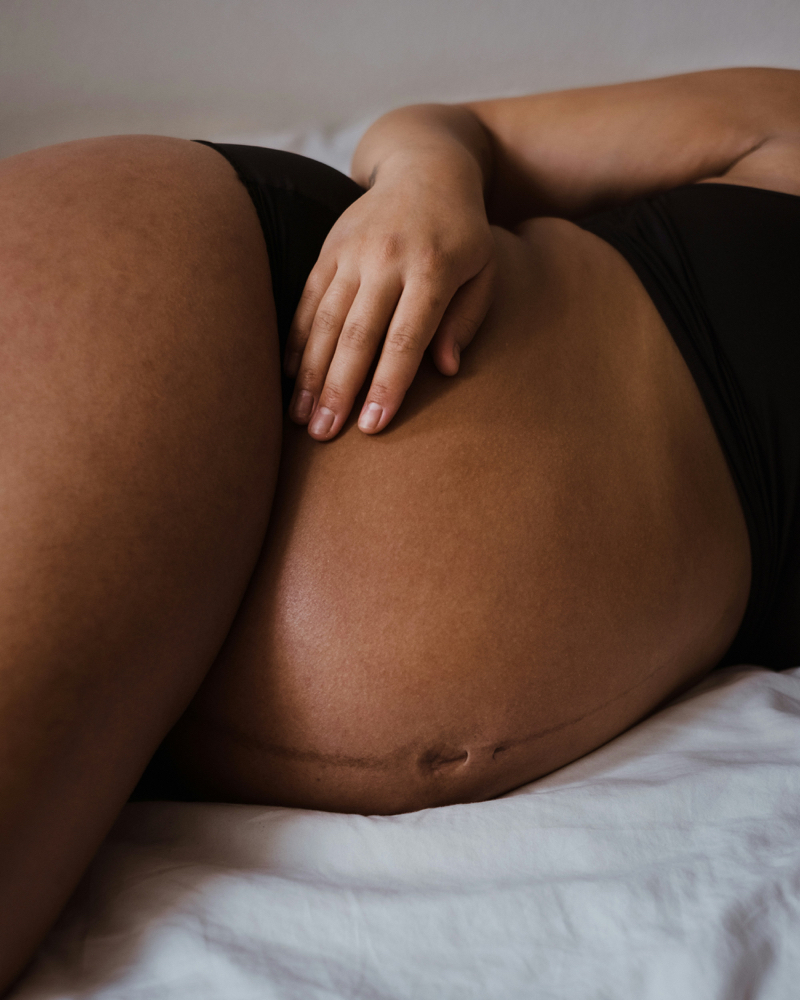 Pregnancy Massage