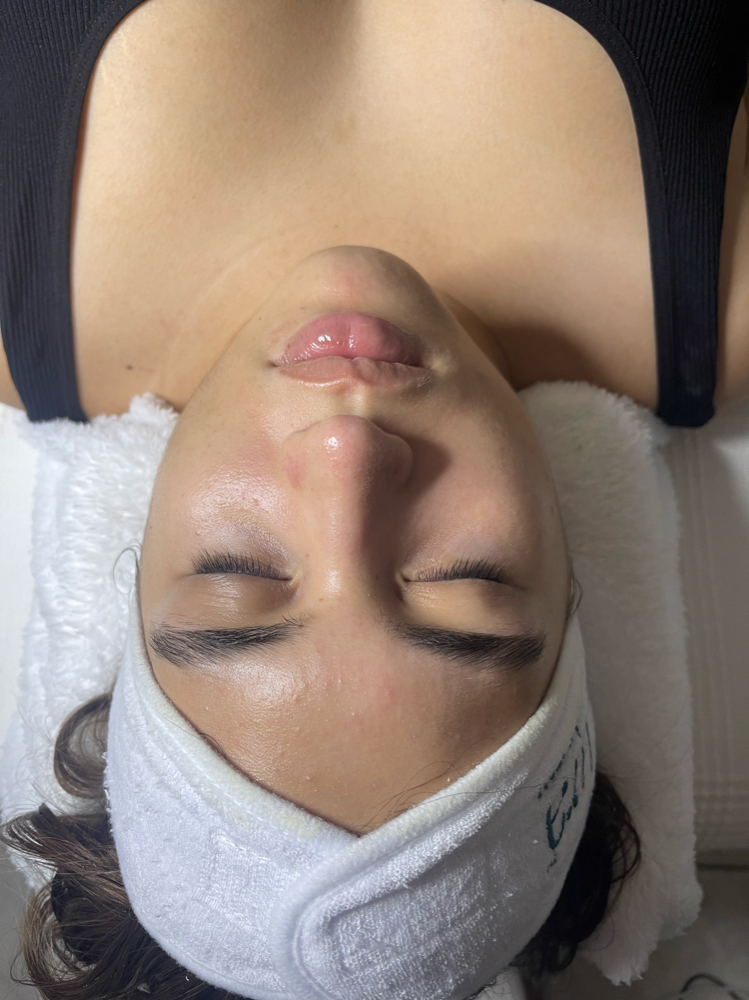 Vita Brite Peel