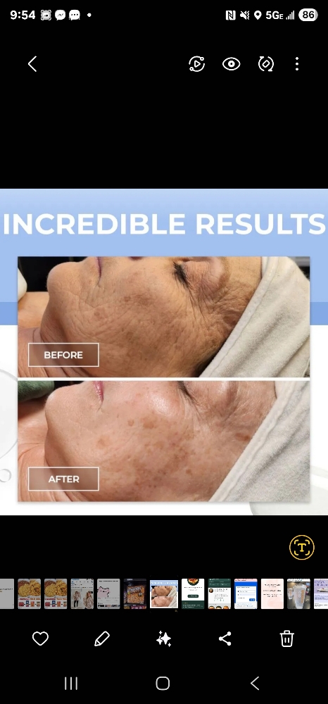 Chemical Peel With Pumpkin Enzyme