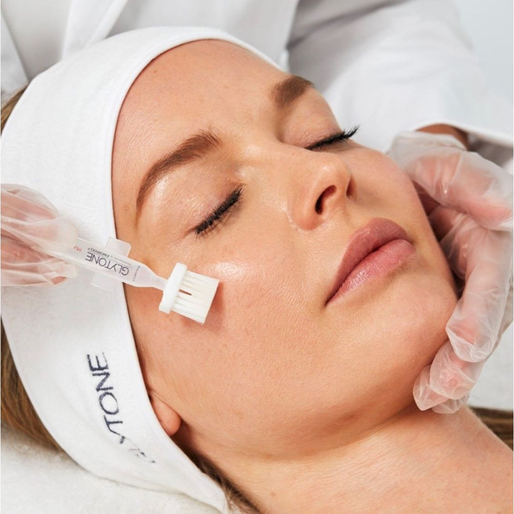 Glytone Chemical Peel